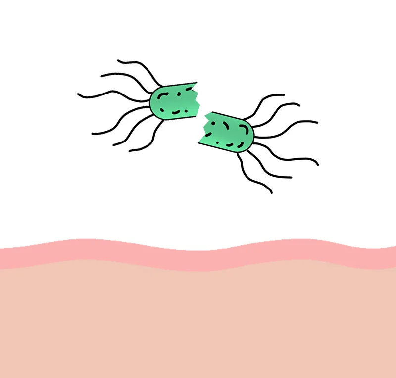 Stomach lining cross-section — worn on one
side, thicker and supported on the other